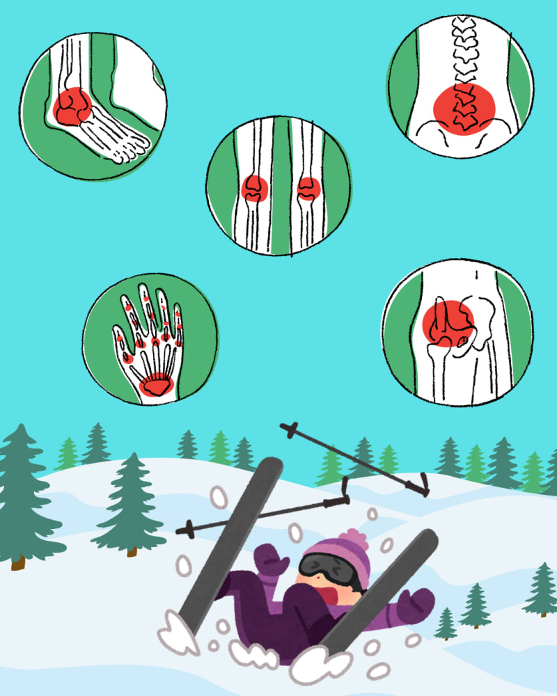 Common Winter Injuries | Motion Works Physiotherapy Orleans